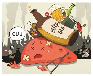 bệnh sỏi gan có nguy hiểm không