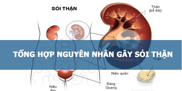 Sỏi Mật Trái Sung