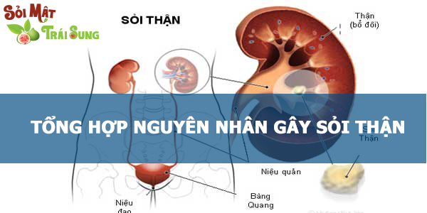 Sỏi Mật Trái Sung