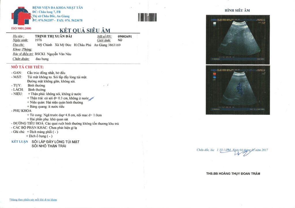 Sỏi Mật Trái Sung