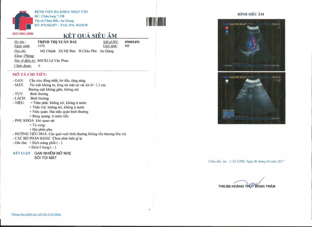 Sỏi Mật Trái Sung