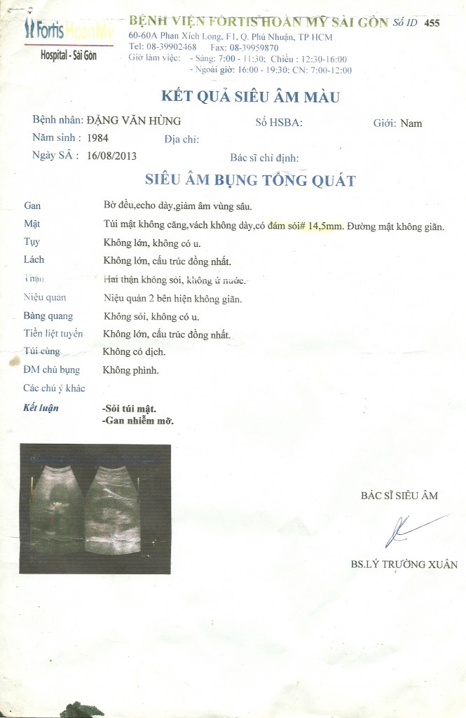 Sỏi Mật Trái Sung
