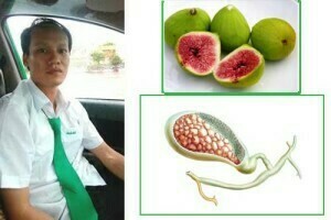 túi mật