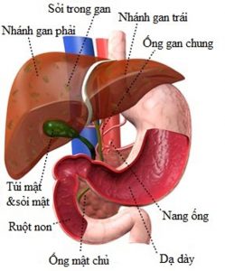 Bệnh sỏi trong gan và cách điều trị