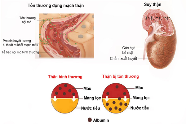 Sỏi Mật Trái Sung