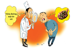 tác hại của bệnh sỏi mật