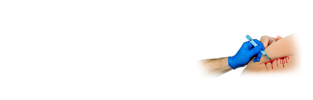 Sỏi Mật Trái Sung