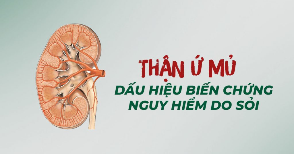 Sỏi Mật Trái Sung