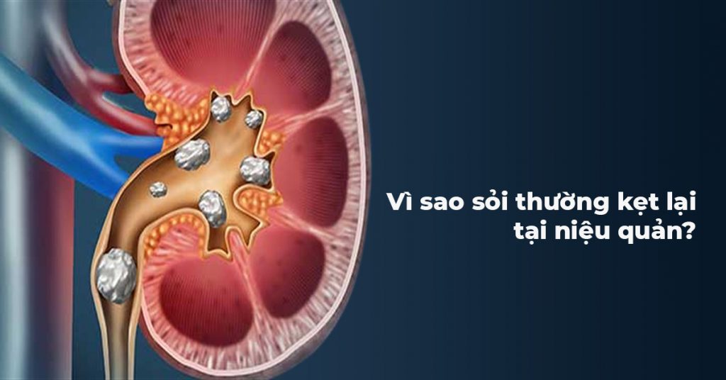 Sỏi Mật Trái Sung