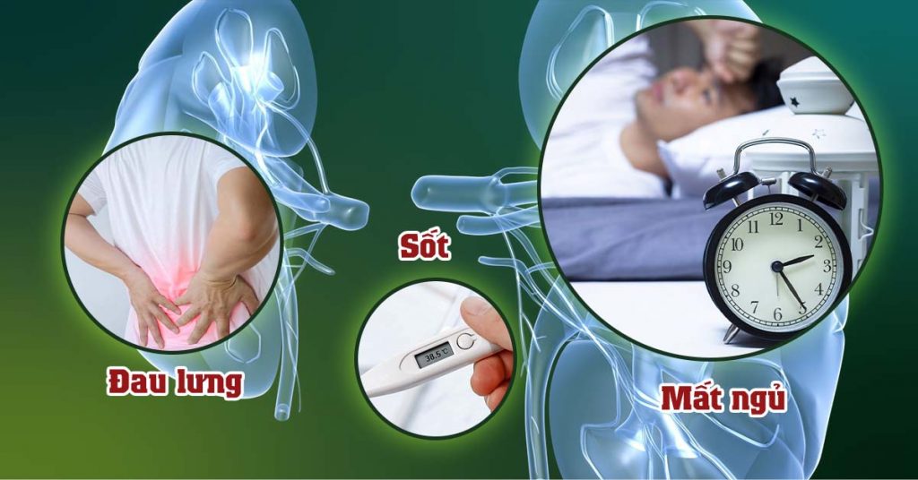 Sỏi Mật Trái Sung