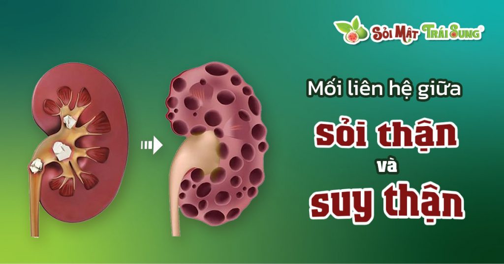 Sỏi Mật Trái Sung