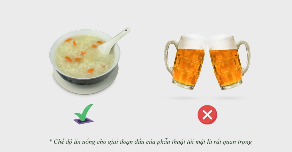 Sỏi Mật Trái Sung