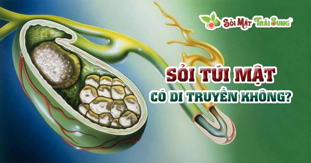 Sỏi Mật Trái Sung