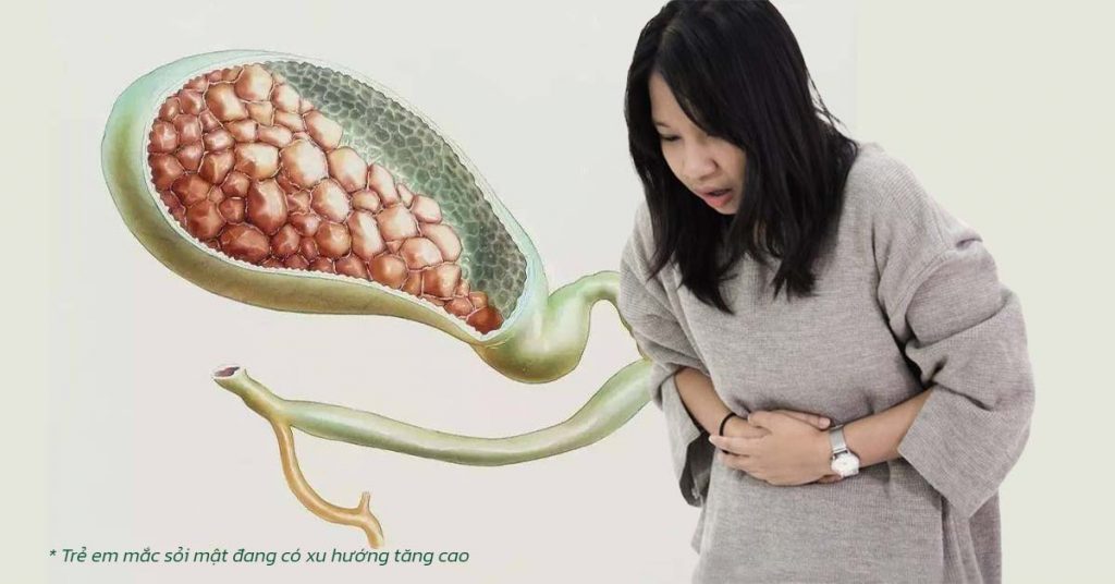 Sỏi Mật Trái Sung