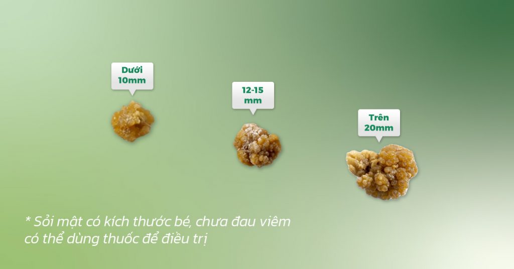 Sỏi Mật Trái Sung