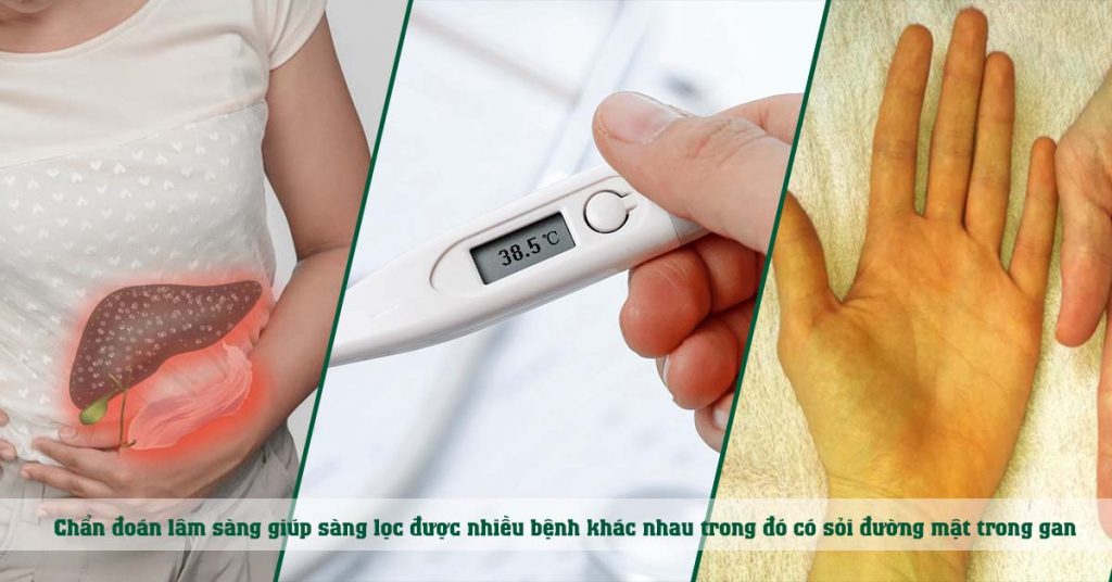 Sỏi Mật Trái Sung