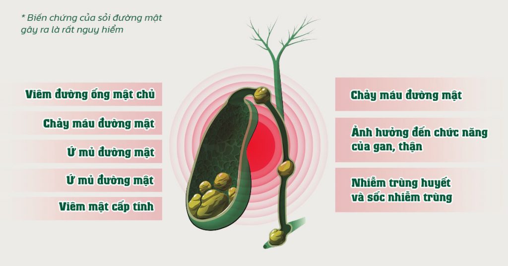 Sỏi Mật Trái Sung