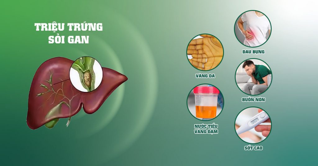 Sỏi Mật Trái Sung