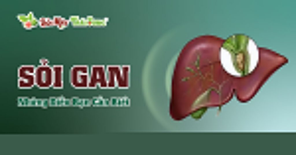 Sỏi Mật Trái Sung