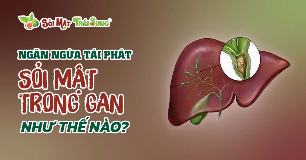 Sỏi Mật Trái Sung