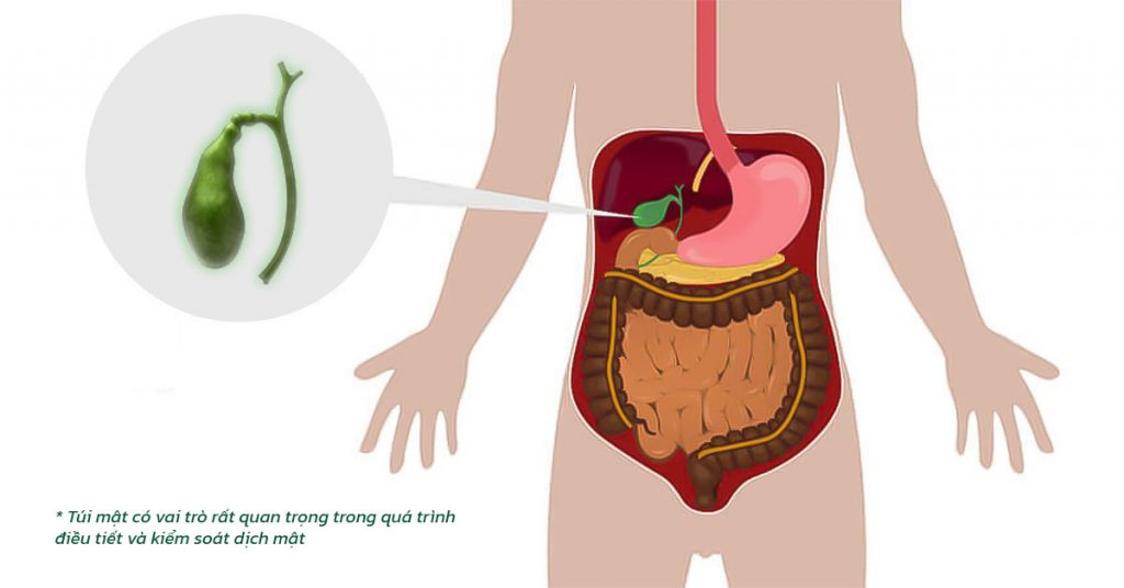 Sỏi Mật Trái Sung