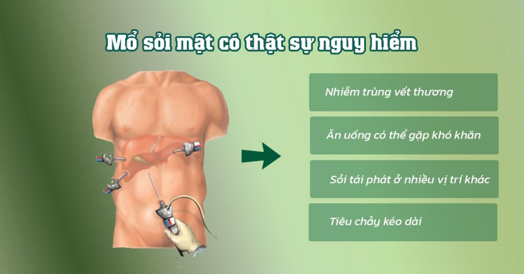 Sỏi Mật Trái Sung