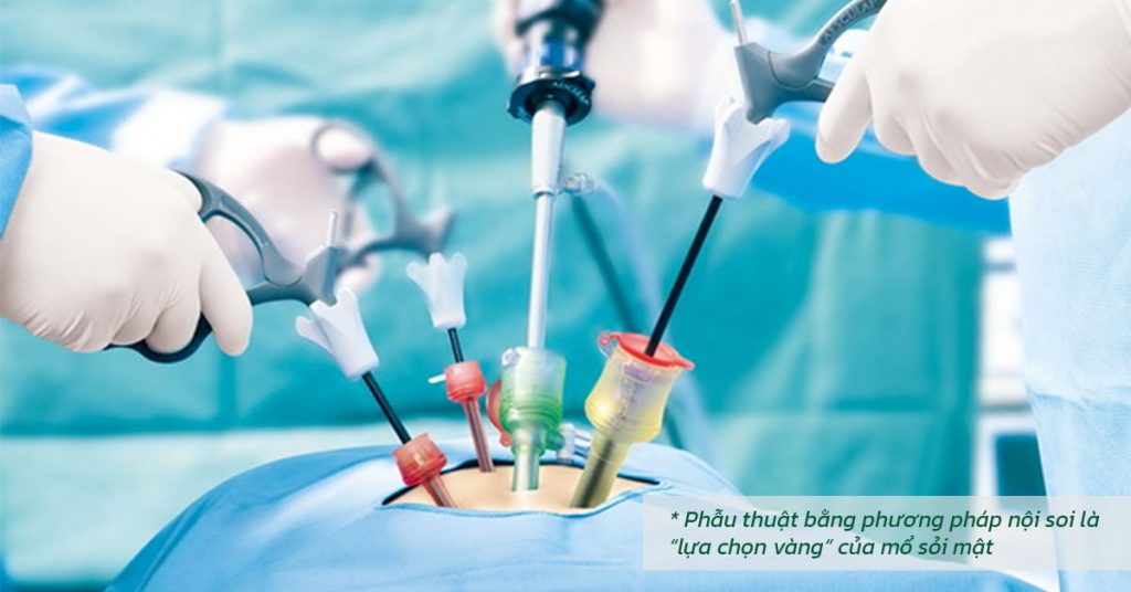 Sỏi Mật Trái Sung