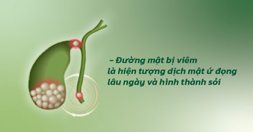 Sỏi Mật Trái Sung