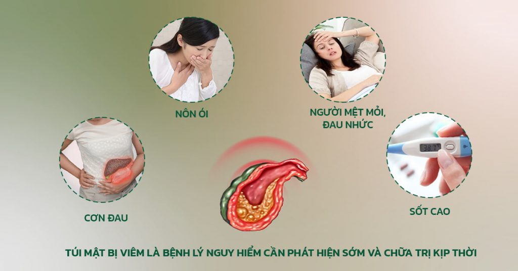 Sỏi Mật Trái Sung