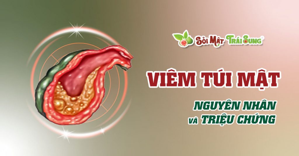 Sỏi Mật Trái Sung