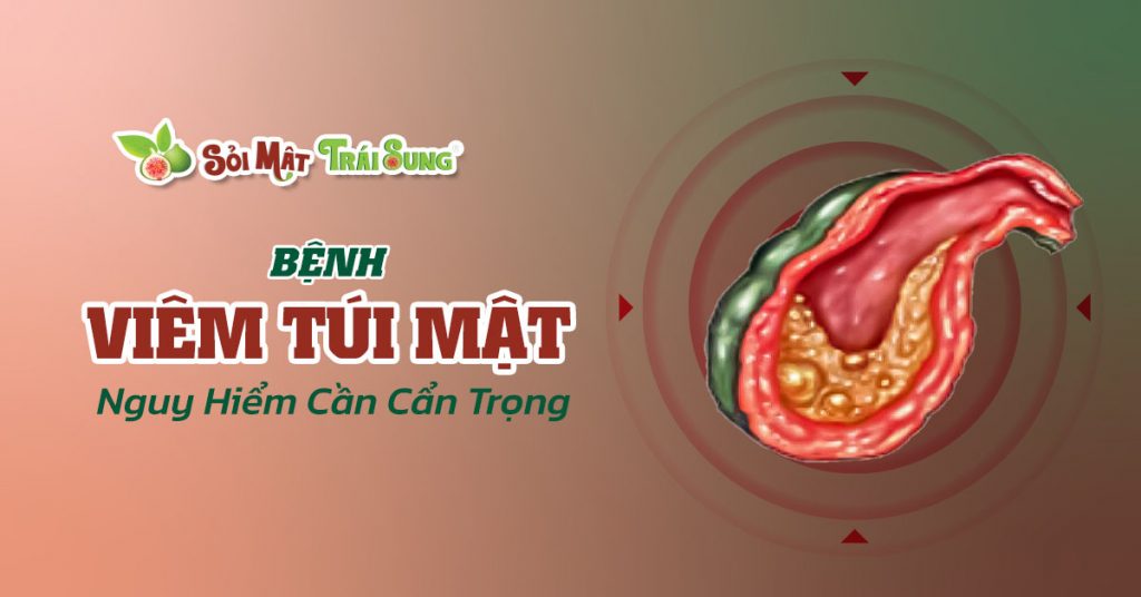 Sỏi Mật Trái Sung