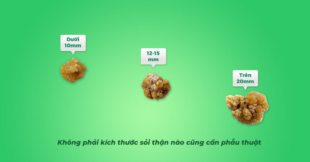 Sỏi Mật Trái Sung
