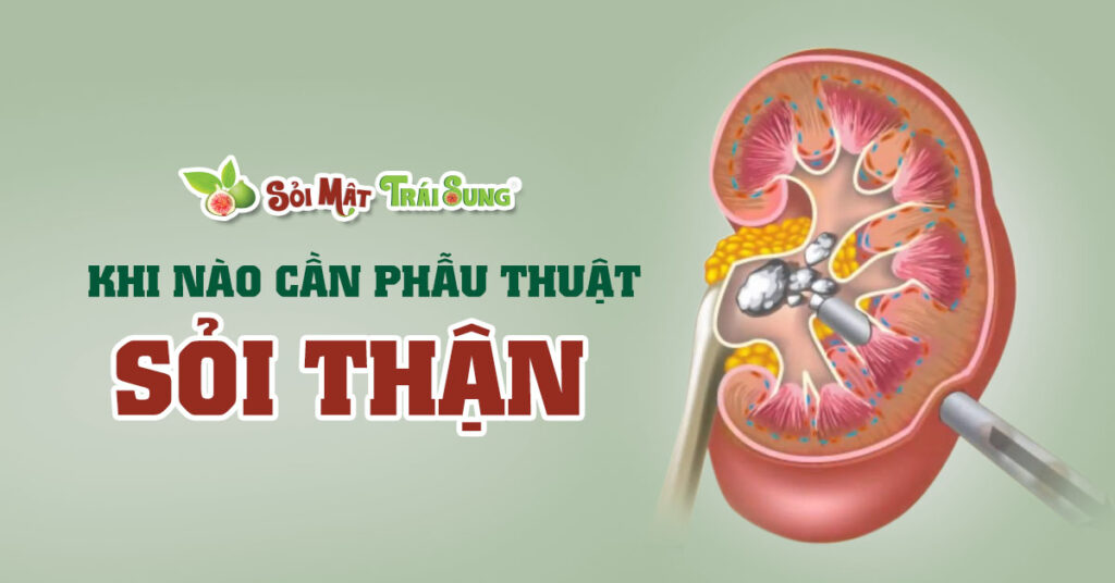 Sỏi Mật Trái Sung