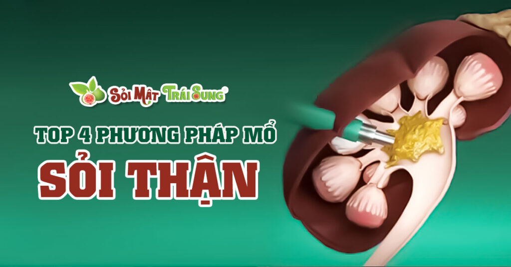 Sỏi Mật Trái Sung
