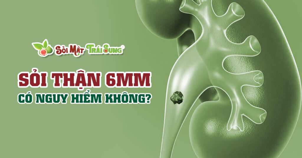Sỏi Mật Trái Sung