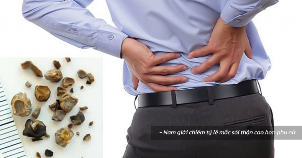 Sỏi Mật Trái Sung