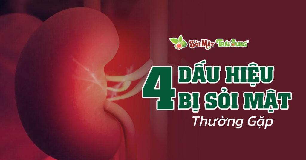 Sỏi Mật Trái Sung