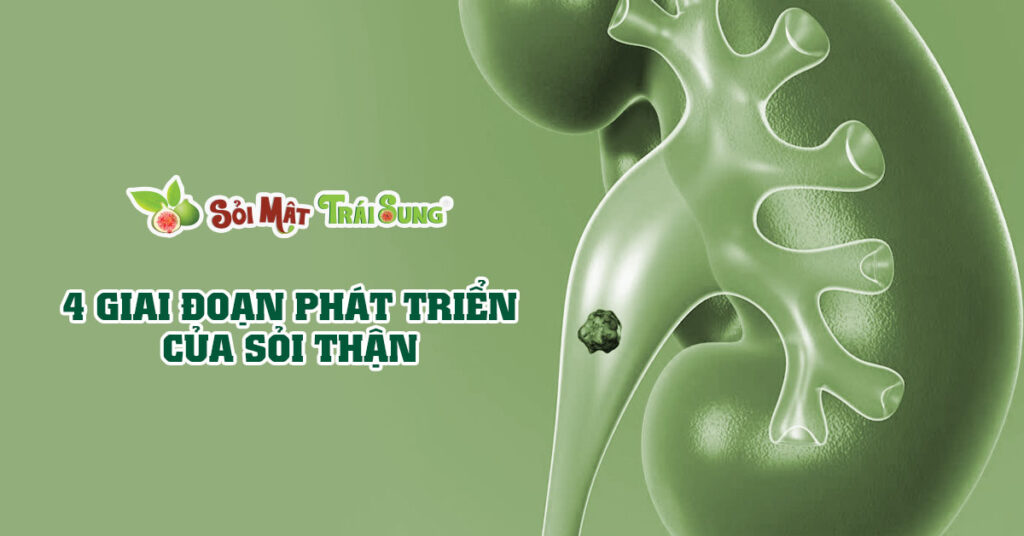 Sỏi Mật Trái Sung
