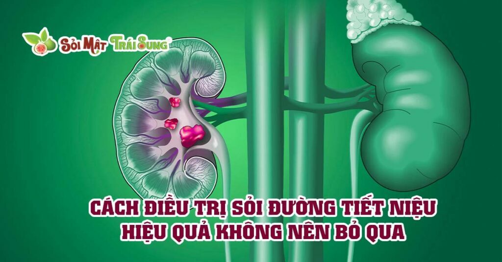Sỏi Mật Trái Sung