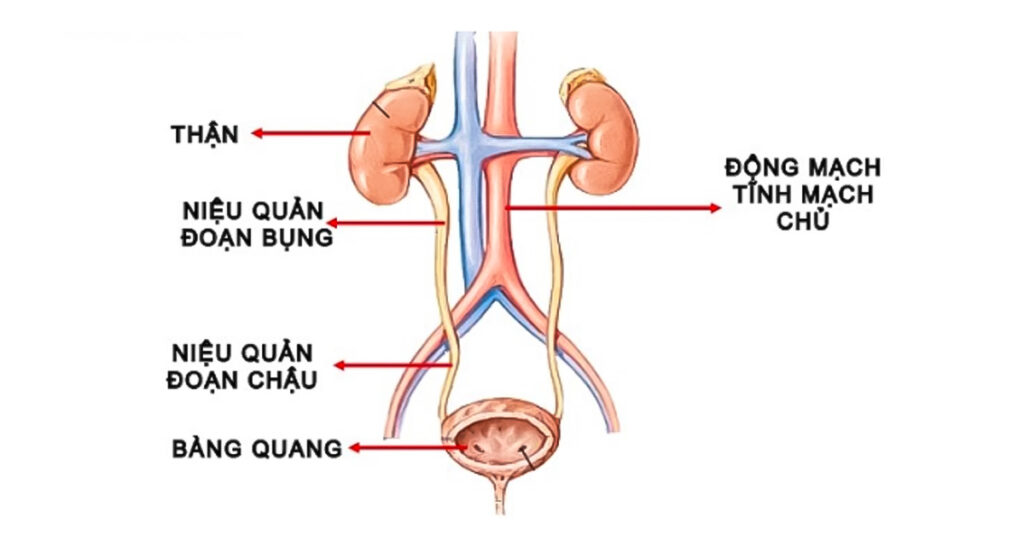 Sỏi Mật Trái Sung
