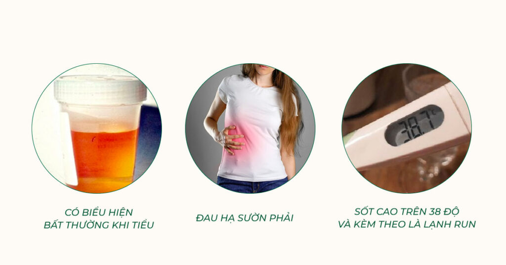 Sỏi Mật Trái Sung