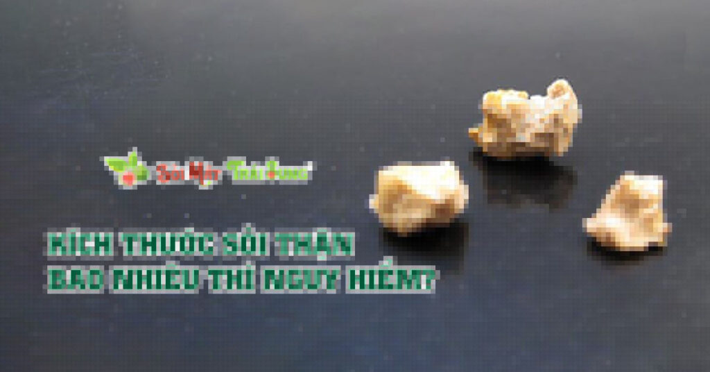 Sỏi Mật Trái Sung