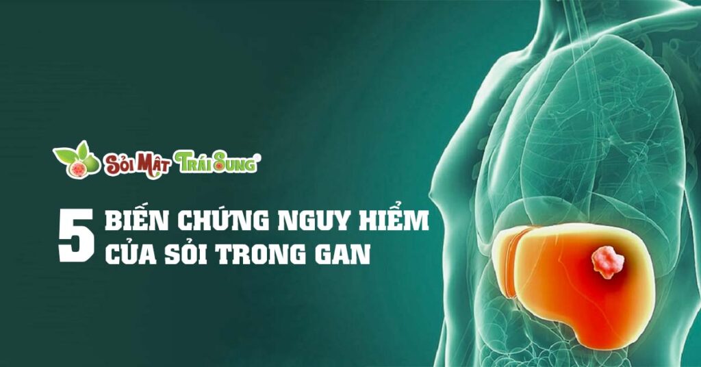 Sỏi Mật Trái Sung
