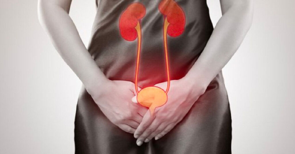 Sỏi Mật Trái Sung