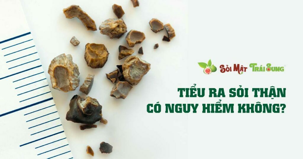 Sỏi Mật Trái Sung