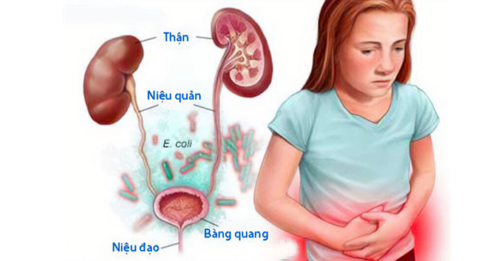 Sỏi Mật Trái Sung