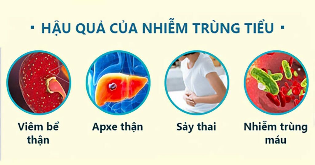 Sỏi Mật Trái Sung