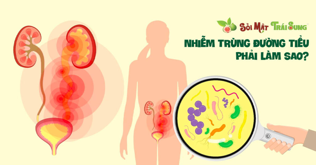 Sỏi Mật Trái Sung