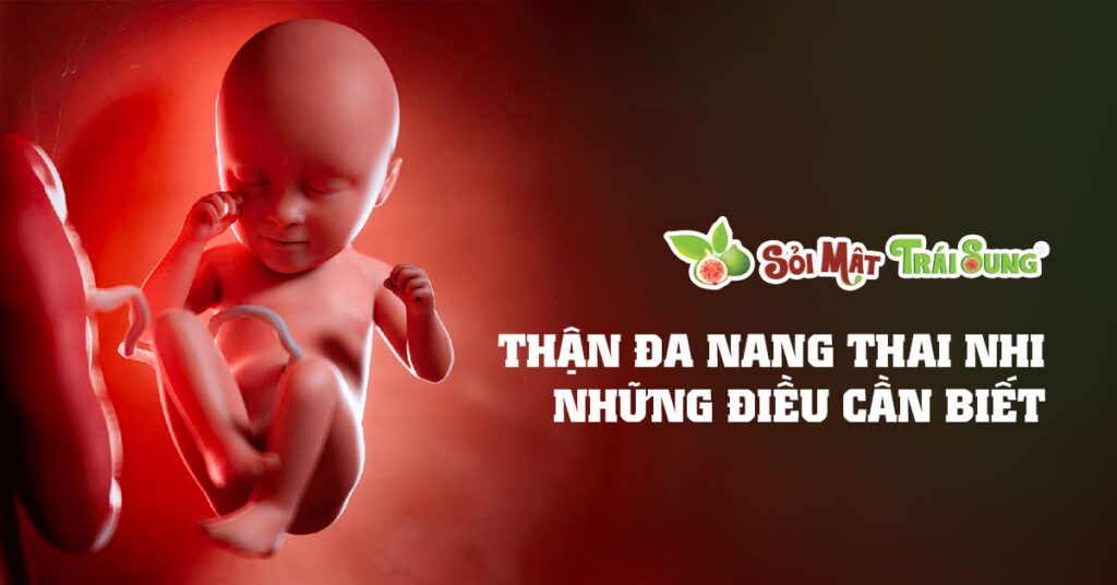 Sỏi Mật Trái Sung
