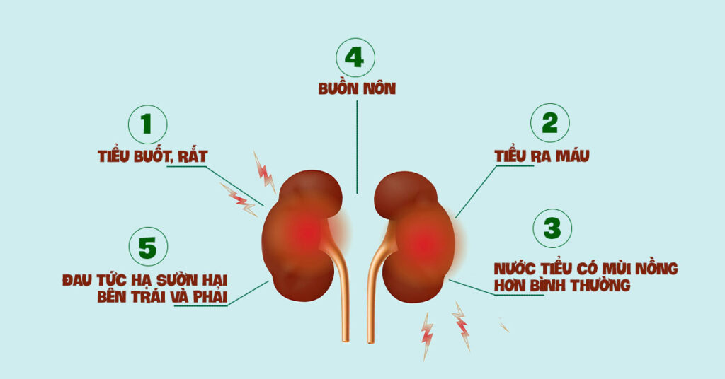 Sỏi Mật Trái Sung